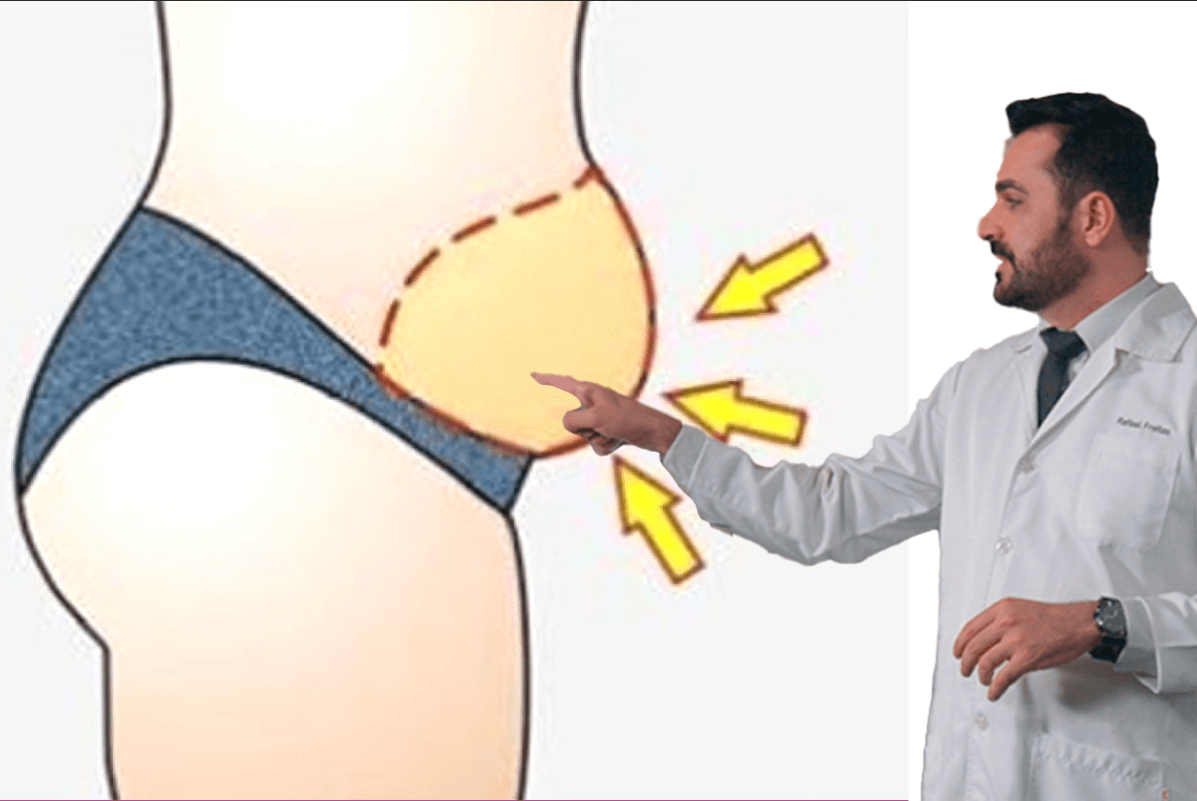 Doutor analisando imagem de gordura abdominal